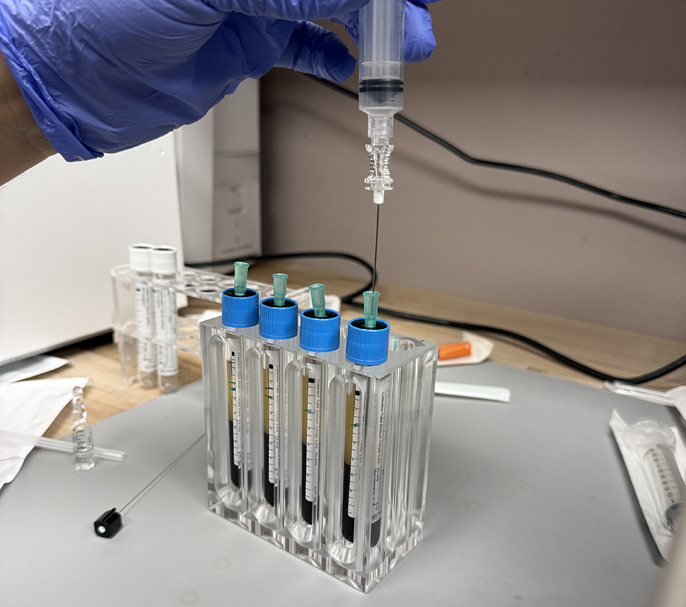 PRP for Nerves