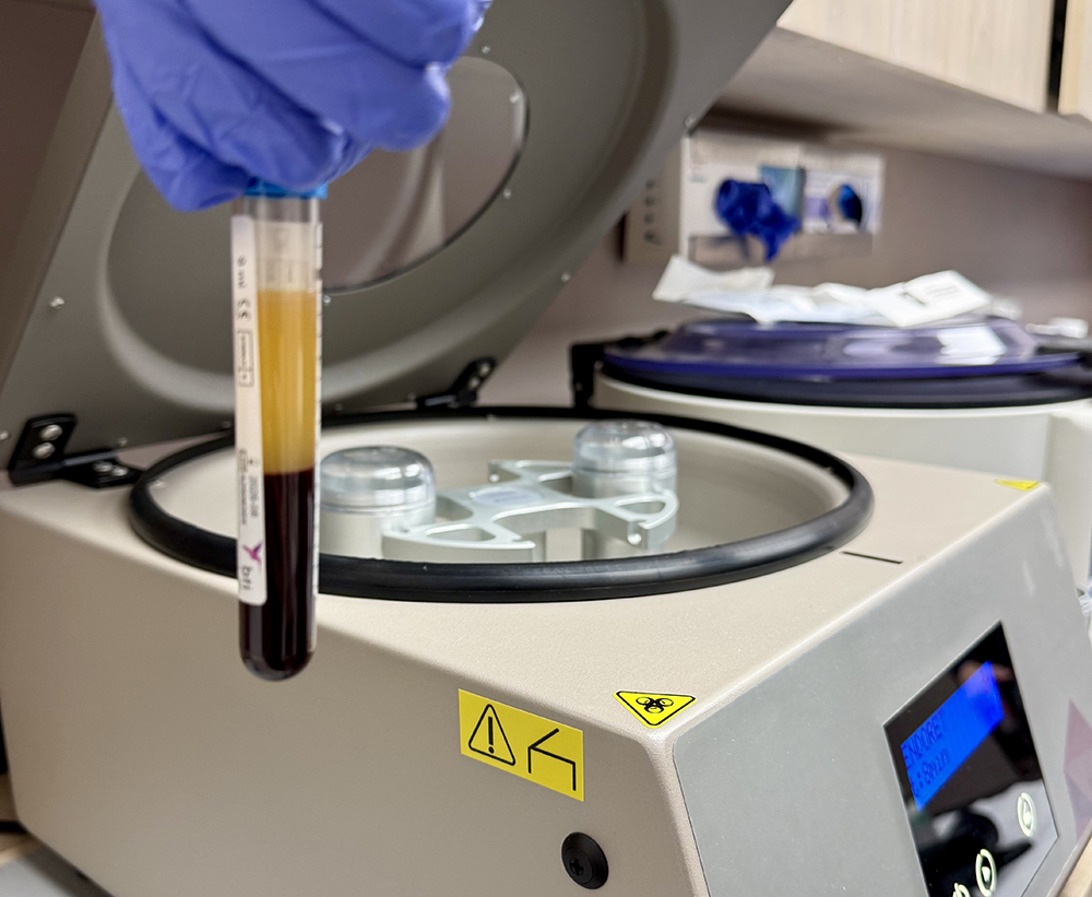 PRP for Neuropathy