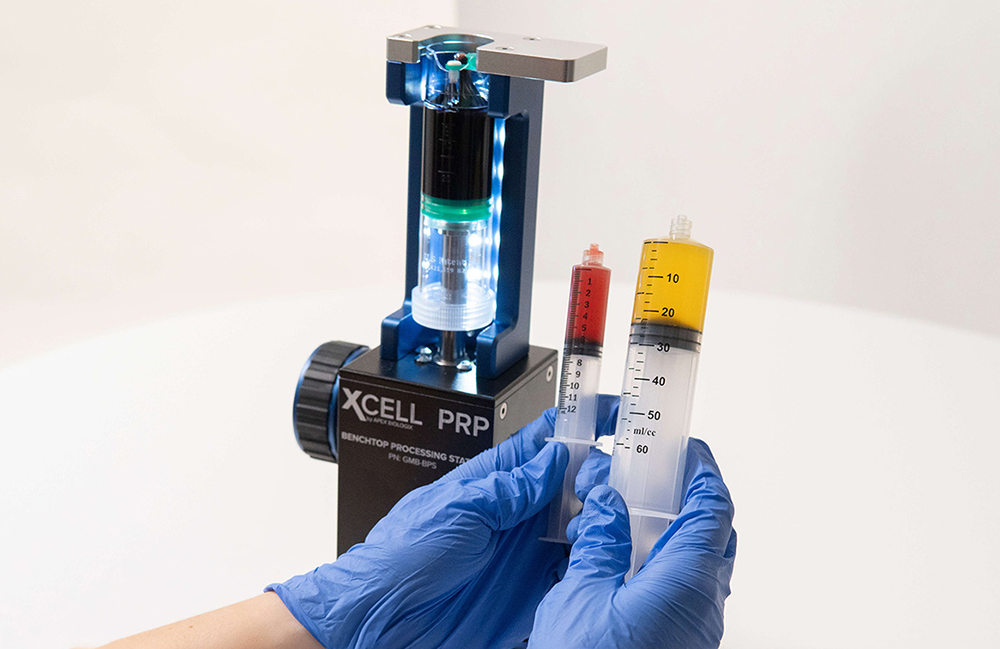 PRP for Spine Injection